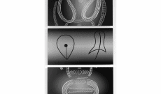 Global Vulva Plates (2014): Altsteinzeitliche Ritzzeichnung (Tschechien) in zwei Teilen, dazwischen Vulva-Symbole
